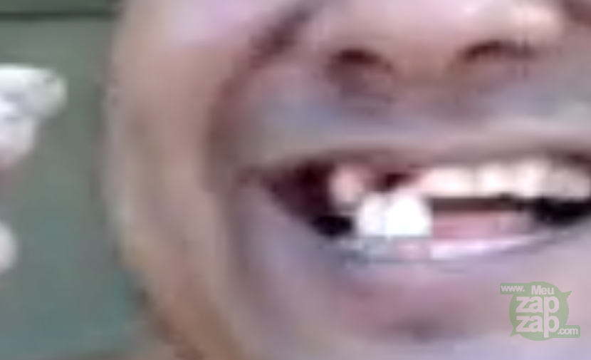 Dentinho comendo milho - Vídeo  Engraçados para Redes Sociais